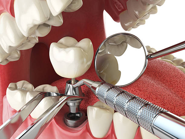Best Emergency Treatment for Dental Infections or Abscesses in Yates Center, KS
